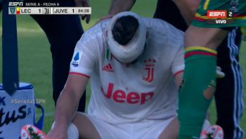 Chwile grozy Gonzalo Higuaina. Gwiazdor Juventusu stracił nawet przytomność